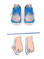 Protector și Separator Hallux Valgus din Silicon – Protecție Monturi 3 în 1. N190 Protector și Separator Hallux Valgus din Silicon – Protecție Monturi 3 în 1. N190
