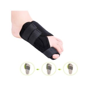 Orteză Hallux Valgus de Noapte pentru Piciorul Stâng – Atelă cu Șină de Corecție